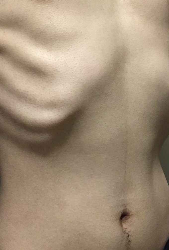 たった一週間で5kg痩せてスリムな体型を手に入れる