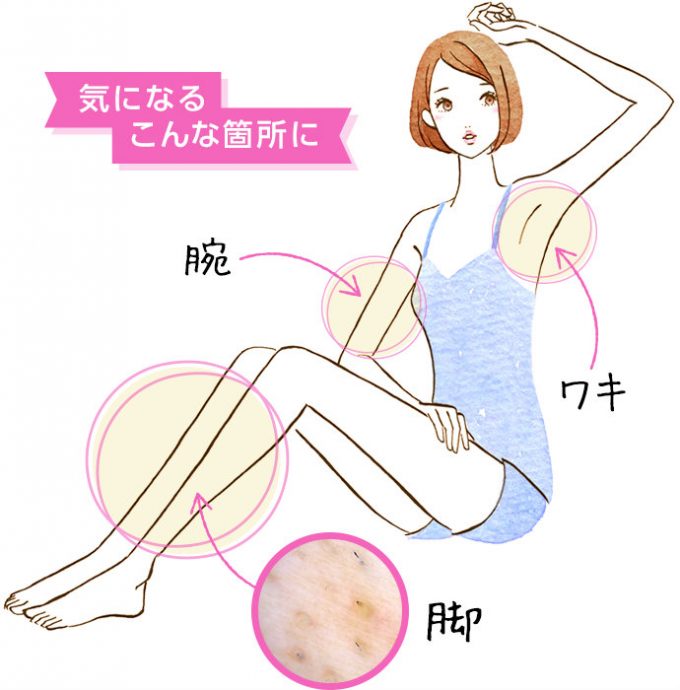 ポツポツ毛穴が気になるこんな箇所に